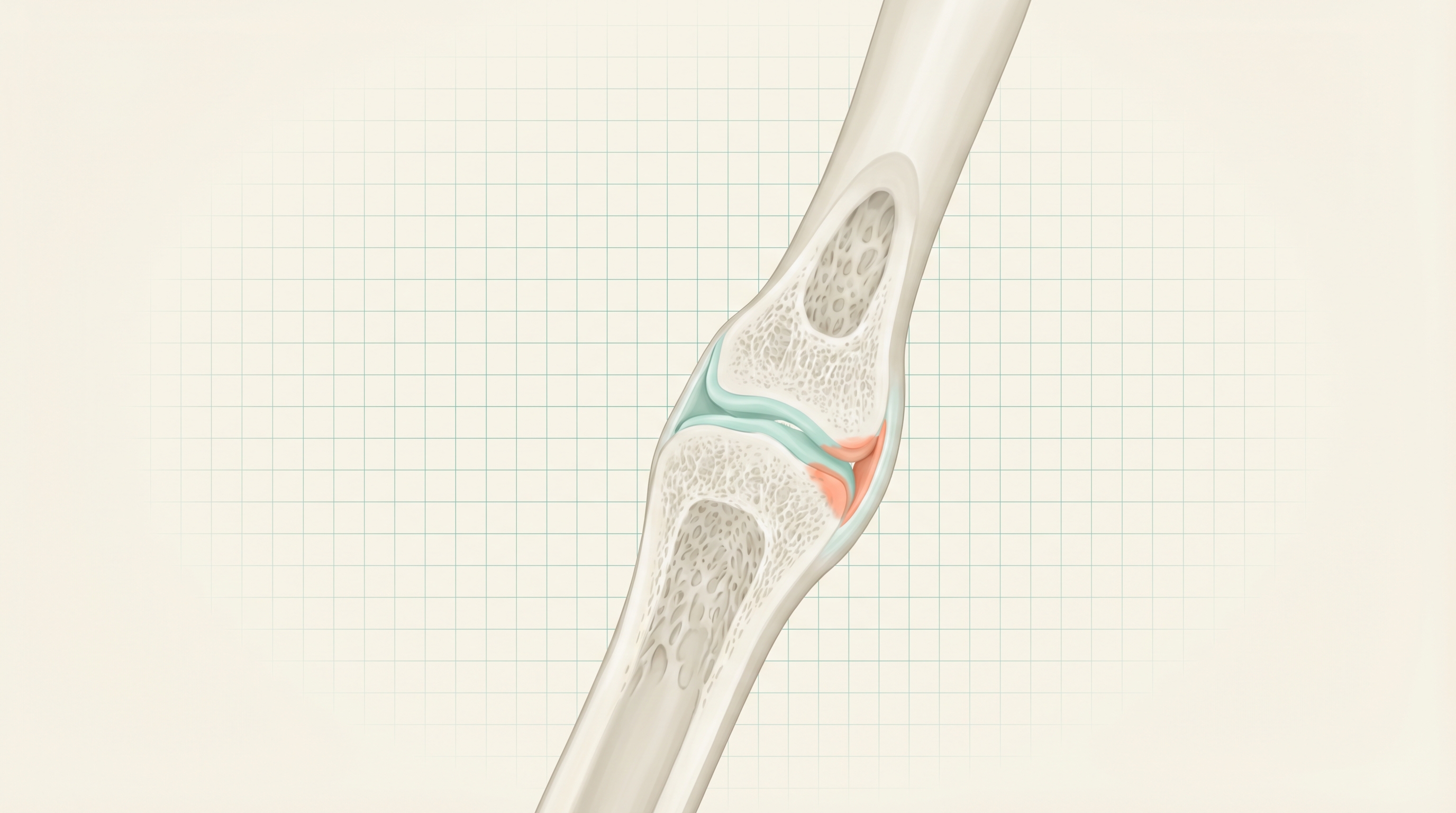 Thumb Arthritis: Symptoms, Treatment